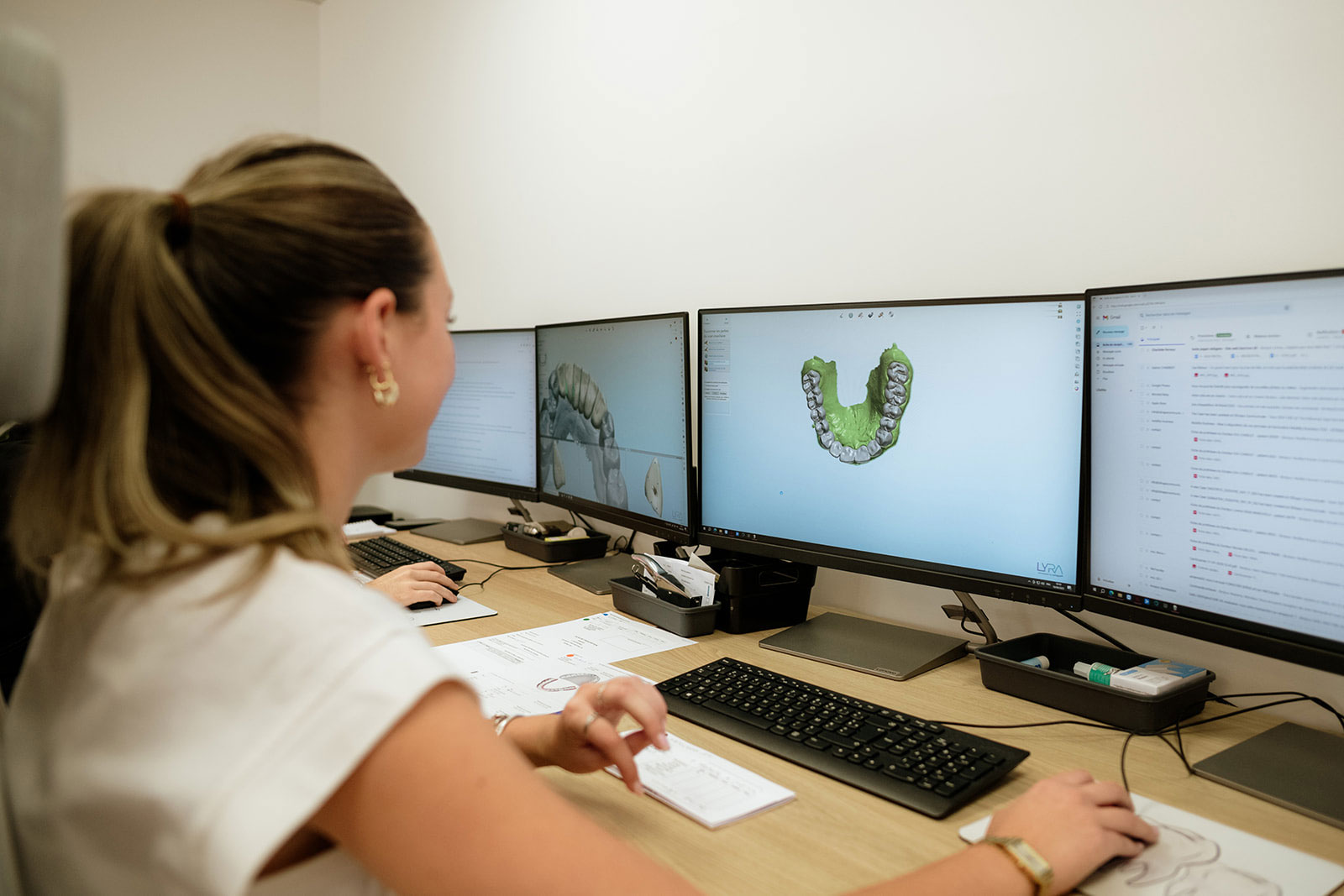 La CFAO dentaire : pilier de notre savoir-faire