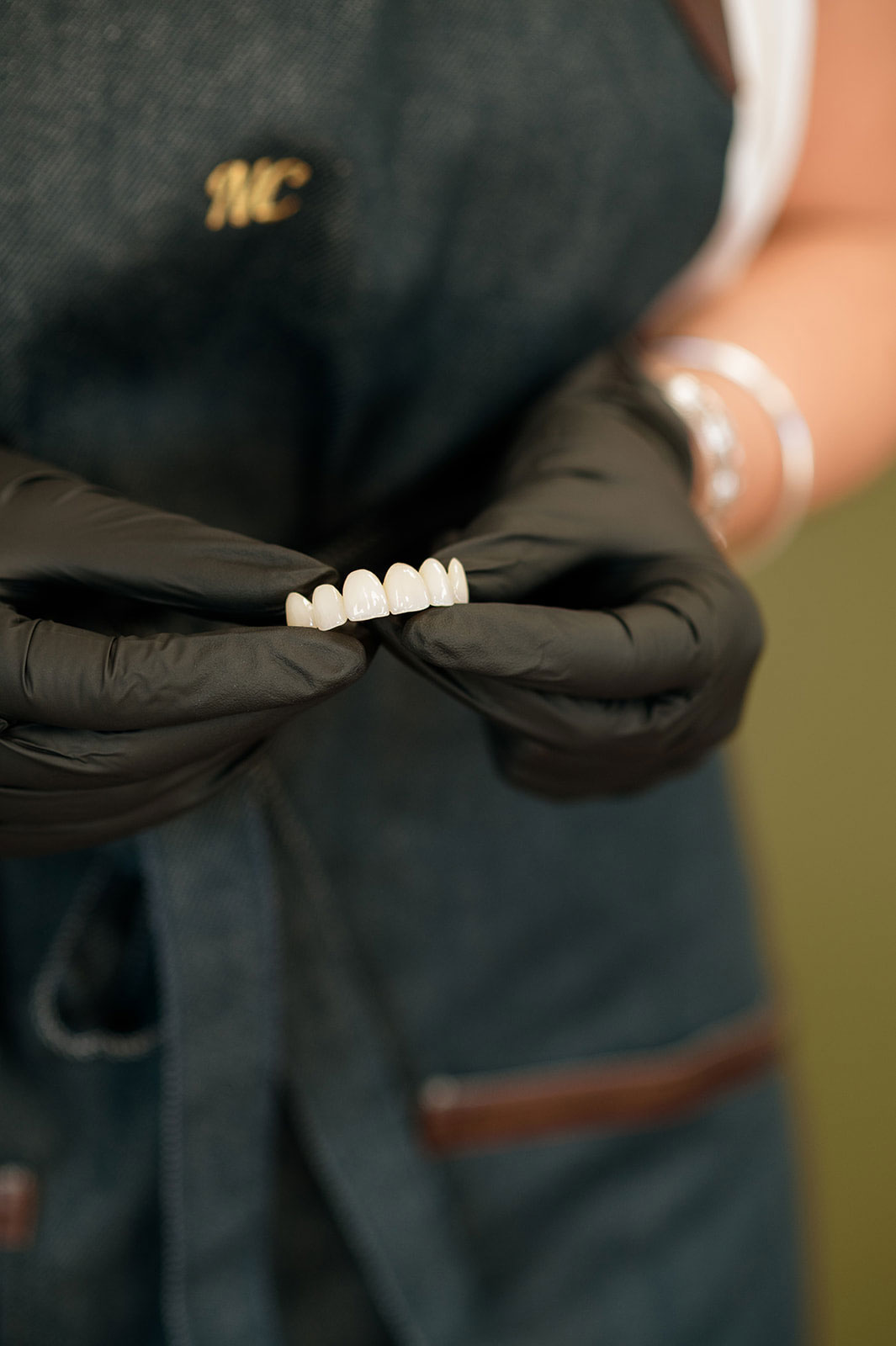 Dentere-3D_prothesiste-dentaire Dent'ere 3D : prothésiste dentaire