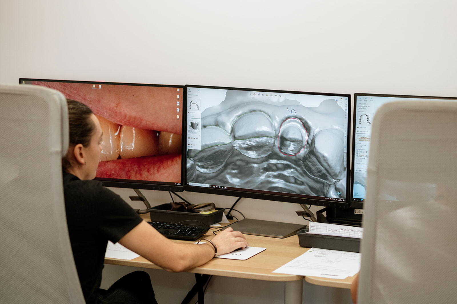 Dent’ere 3D : votre laboratoire CFAO dans le Gard