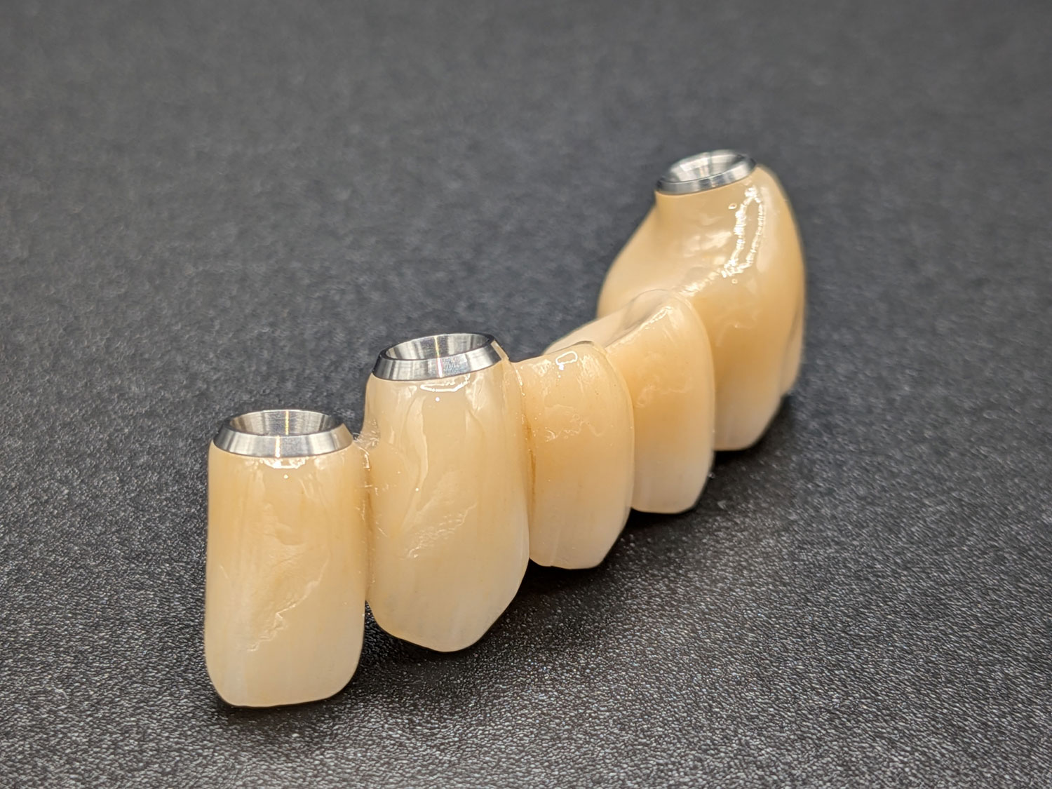 Bridge sur implants dentaires en céramique Bridge sur implants dentaires céramiques