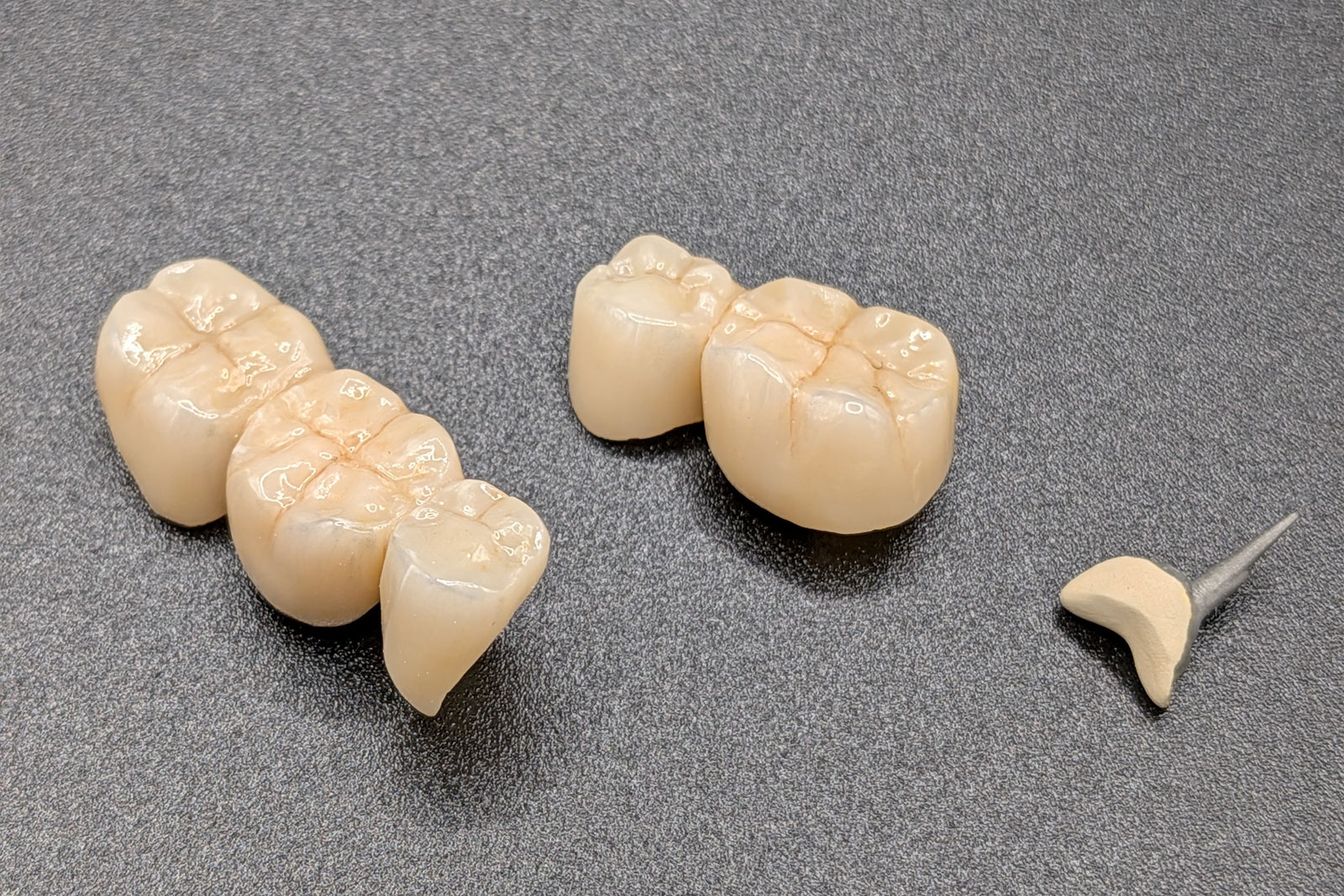 Couronnes dentaires esthétiques réalisées sur mesure